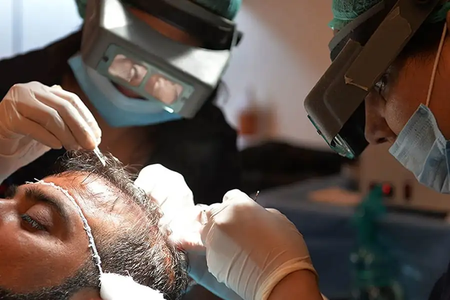 robotergestützte Haartransplantation