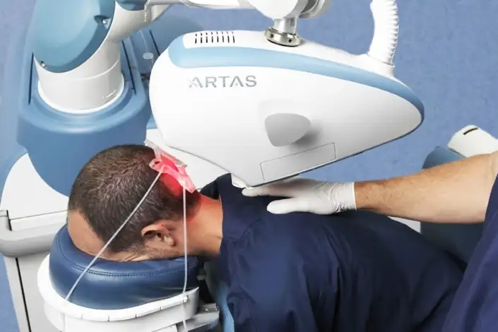 ▷ Roboter Haartransplantation | Roboter Methode 2022