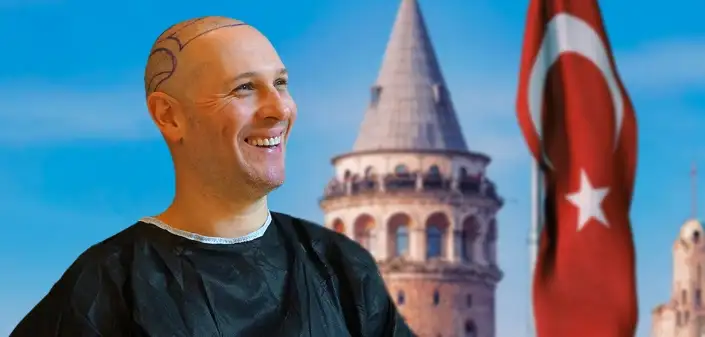▷ Beste Haartransplantation Klinik in der Istanbul Türkei