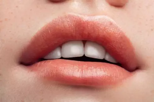 Natürliches Lippenfüllung | Techniken und Kosten in Türkei?